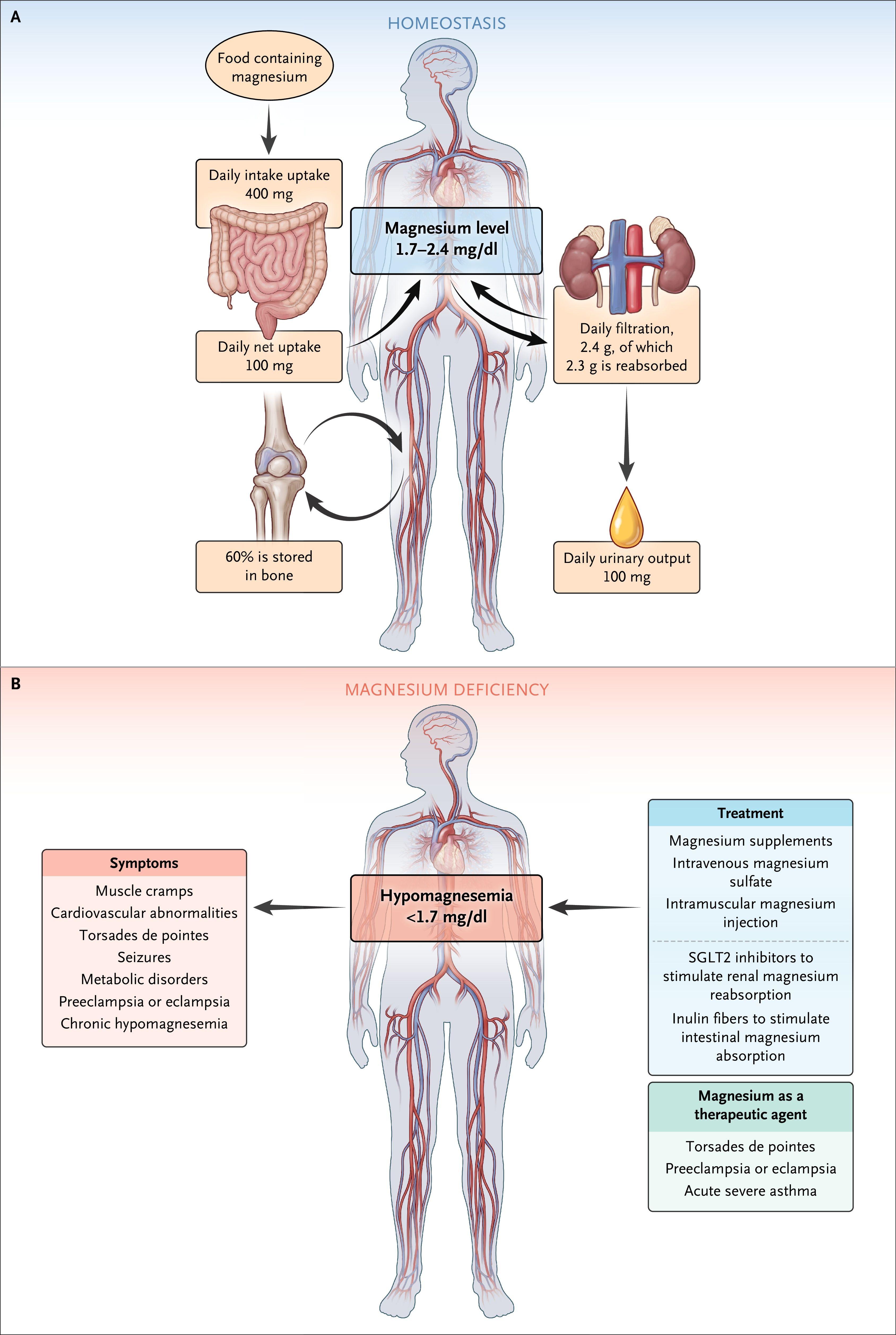 Magnesium Homeostasis and Signs and Symptoms of Hypomagnesemia and Therapeutic Approaches.