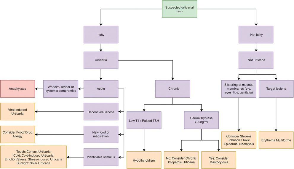 Diagnostic algorithm for the presentation of urticaria.
