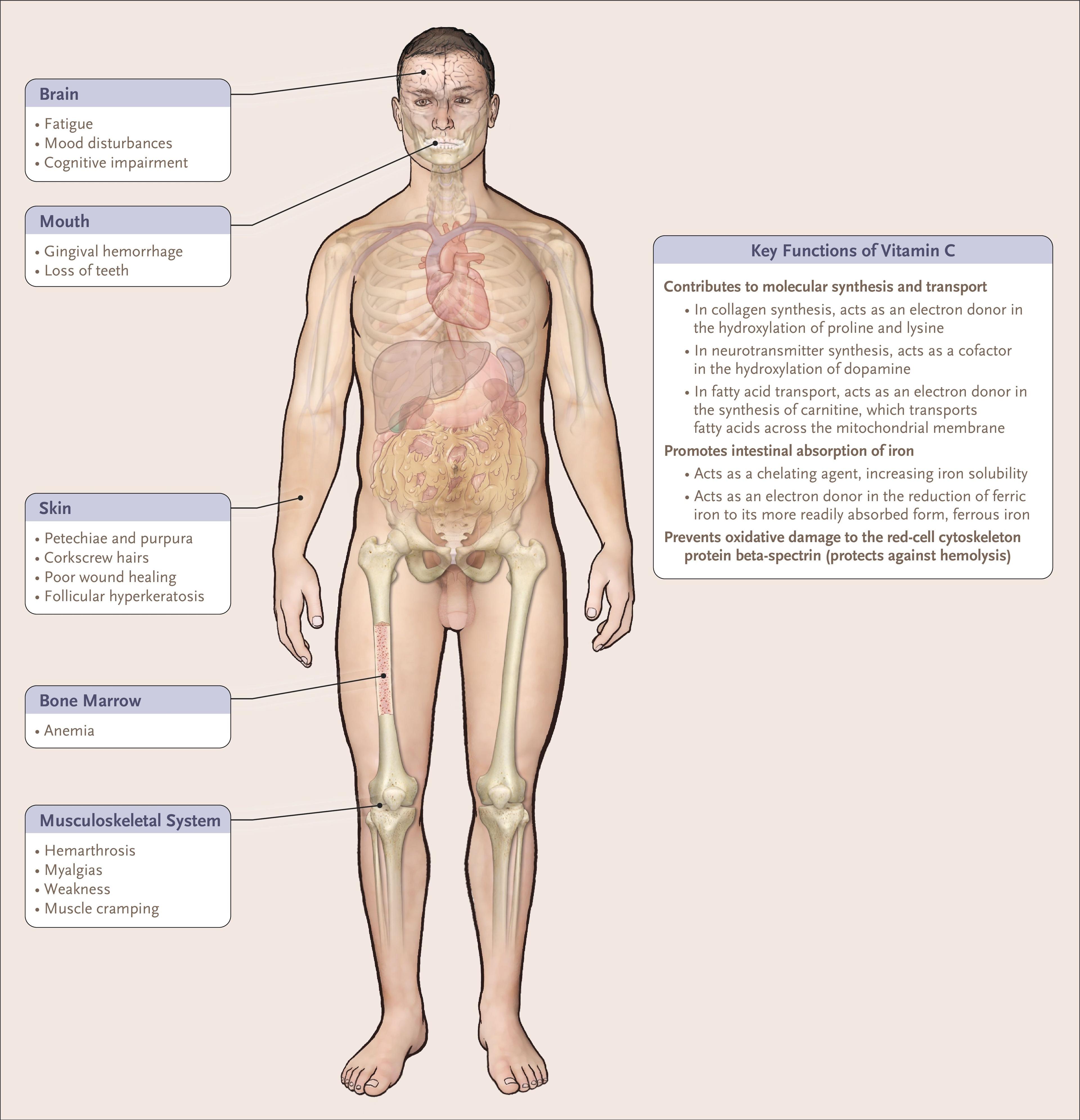 Consequences of Vitamin C Deficiency.