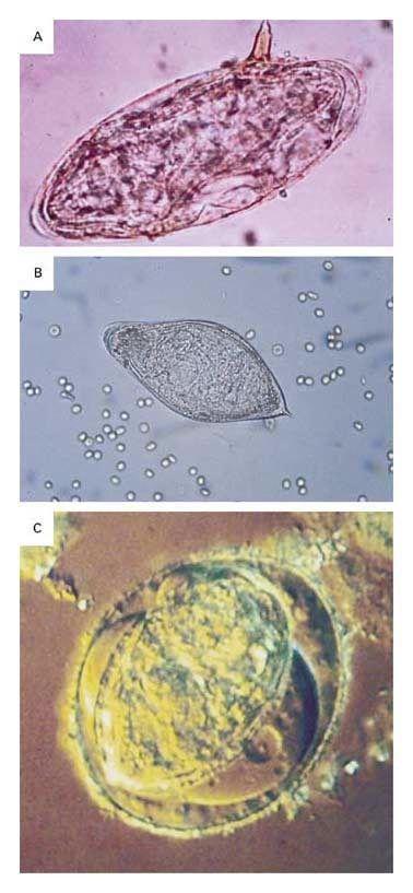 Morphology of the Eggs of the Three Key Schistosomes That Infect Humans.