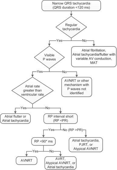 Differential Diagnosis for Adult Narrow QRS Tachycardia