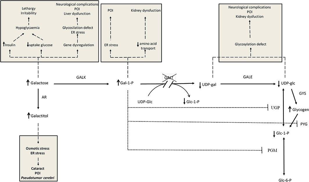 Putative mechanisms of neonatal or long‐term complications in galactose‐1‐phosphate uridyltransferase ( GALT ) deficiency.