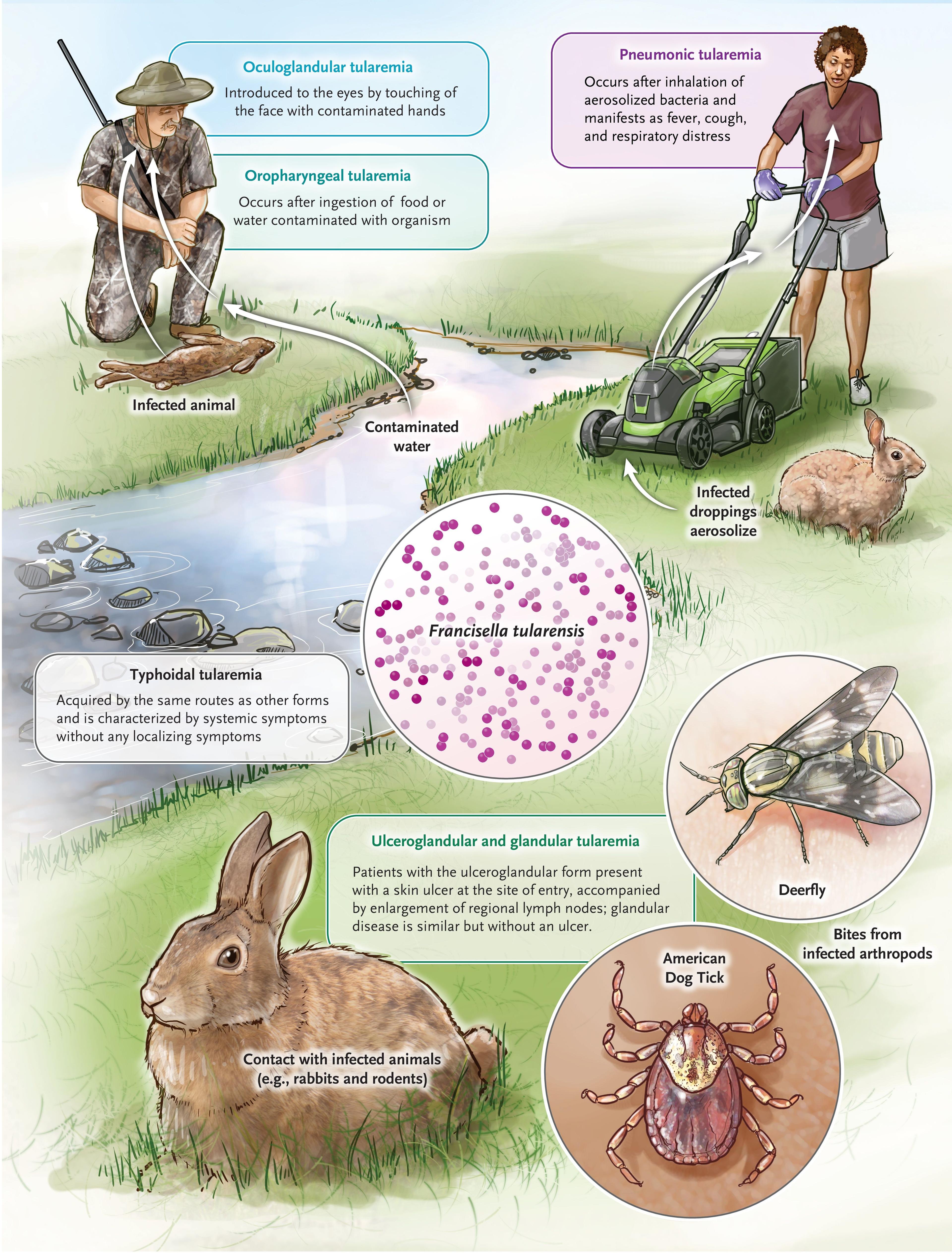 Tularemia — Modes of Acquisition and Manifestations.