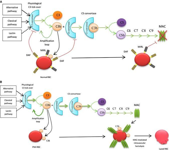 Action of complement in healthy subjects (A) and paroxysmal nocturnal hemoglobinuria ( PNH ) patients (B).