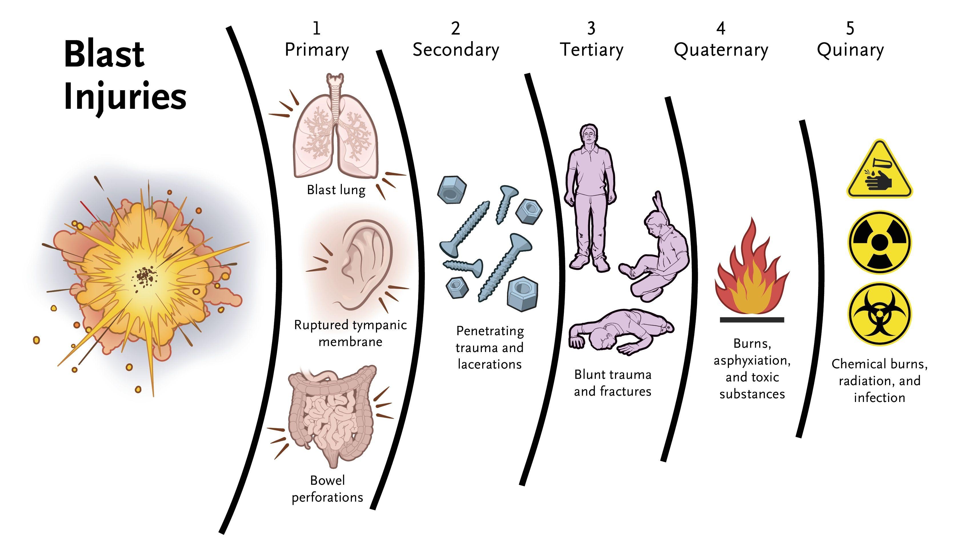 Blast Injury Types and Mechanisms.