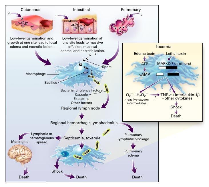 Pathophysiology of Anthrax.