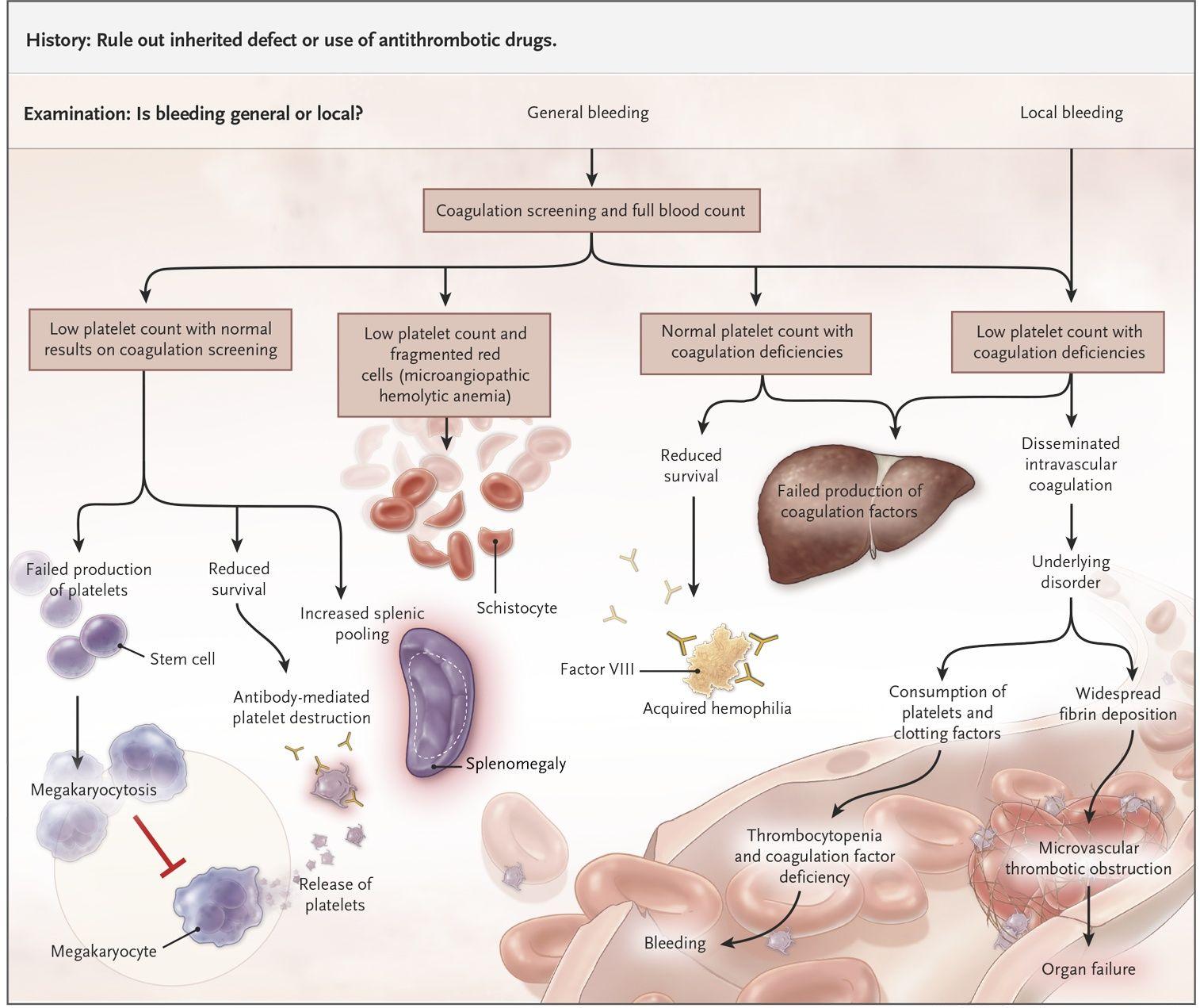 Causes of Bleeding among Patients in the ICU.