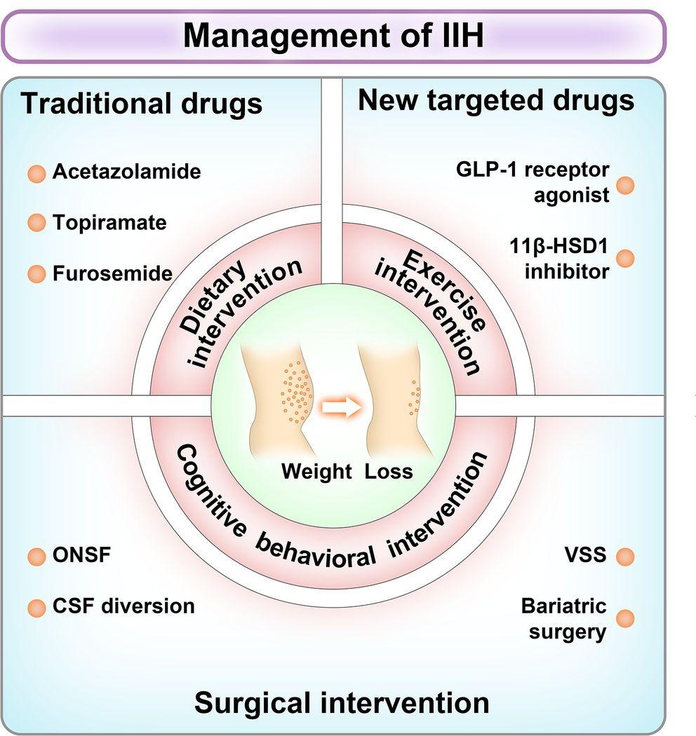 Management of IIH.