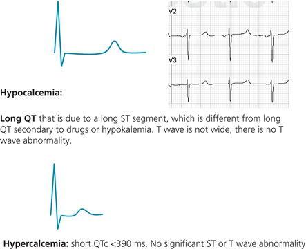 Figure 70. Hypocalcemia and hypercalcemia.
