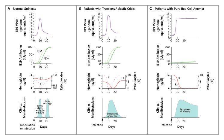 Pathophysiology of Parvovirus B19 Infection.